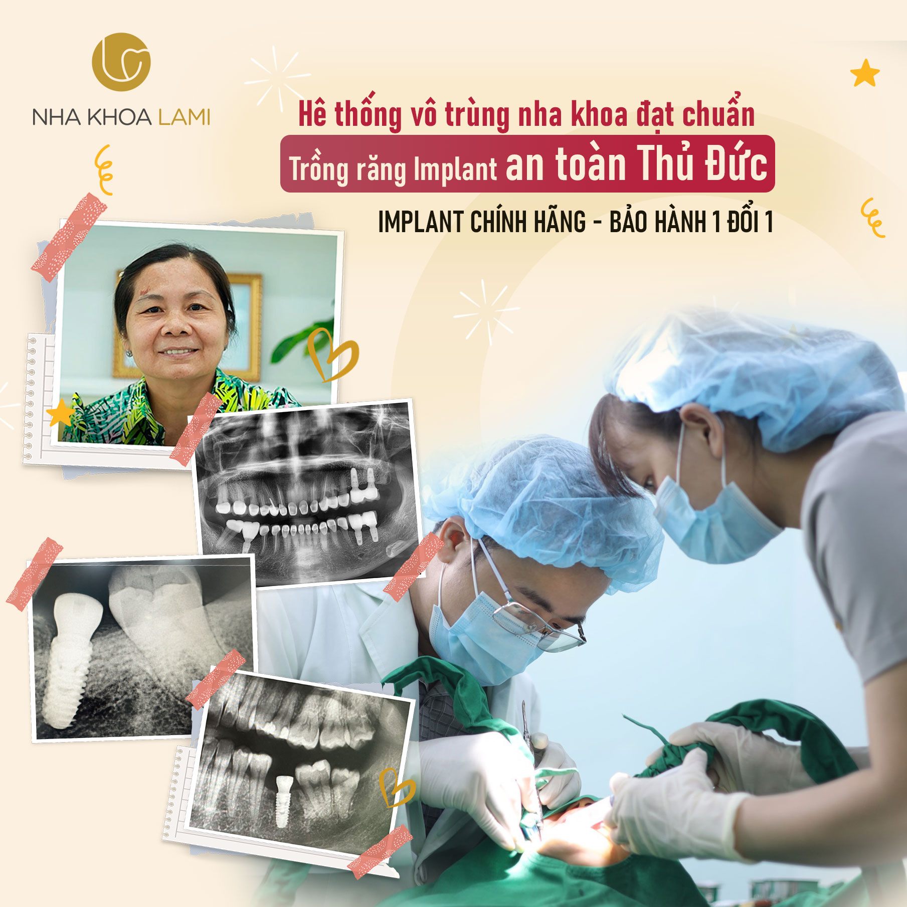 implant 1