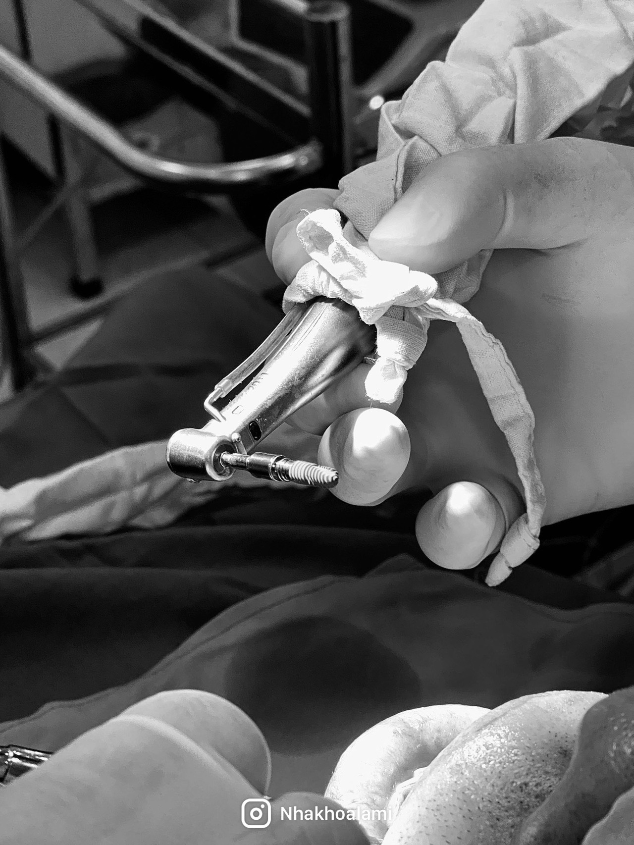 Trồng răng Implant chính hãng giá rẻ Thủ Đức case2707 1